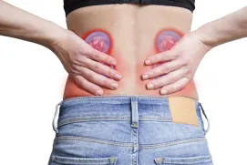 Calcium and uric acid stones are the most common.