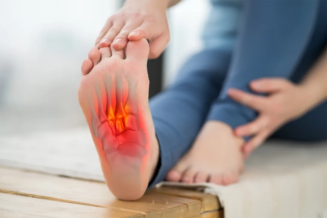 Fascitis plantar: síntomas, diagnóstico y tratamiento 